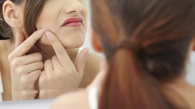 Get Severe About Treating Acne breakouts And Receiving Rid Of It