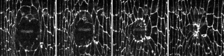 Mechanisms of embryonic wound healing - unleashed 