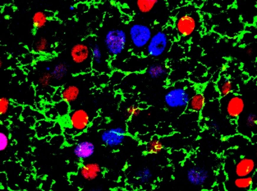 New study shows how microglia are prompted to change their state to adapt to different areas of the brain