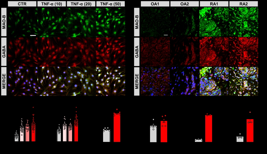 Two birds one stone strategy to treat both joint pain and cognitive impairment in rheumatoid arthritis