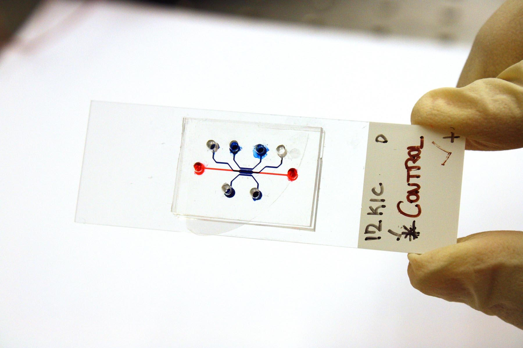 Using cancer cells as logic gates to determine what makes them move