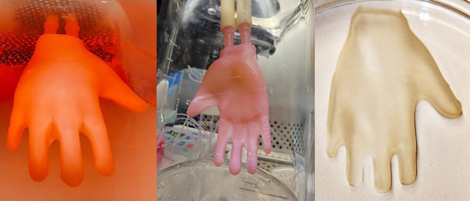 Bioengineered Skin Grafts that Fit Like a Glove