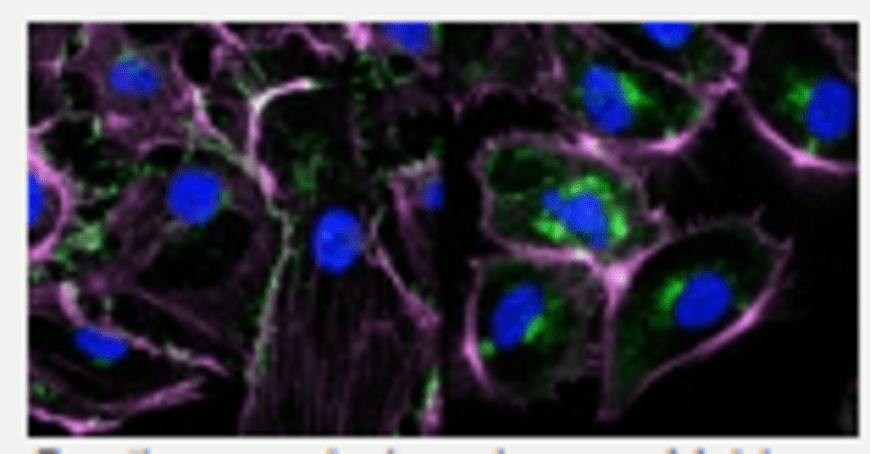 Pseudomonas aeruginosa Bacteria produce a molecule that paralyzes immune system cells