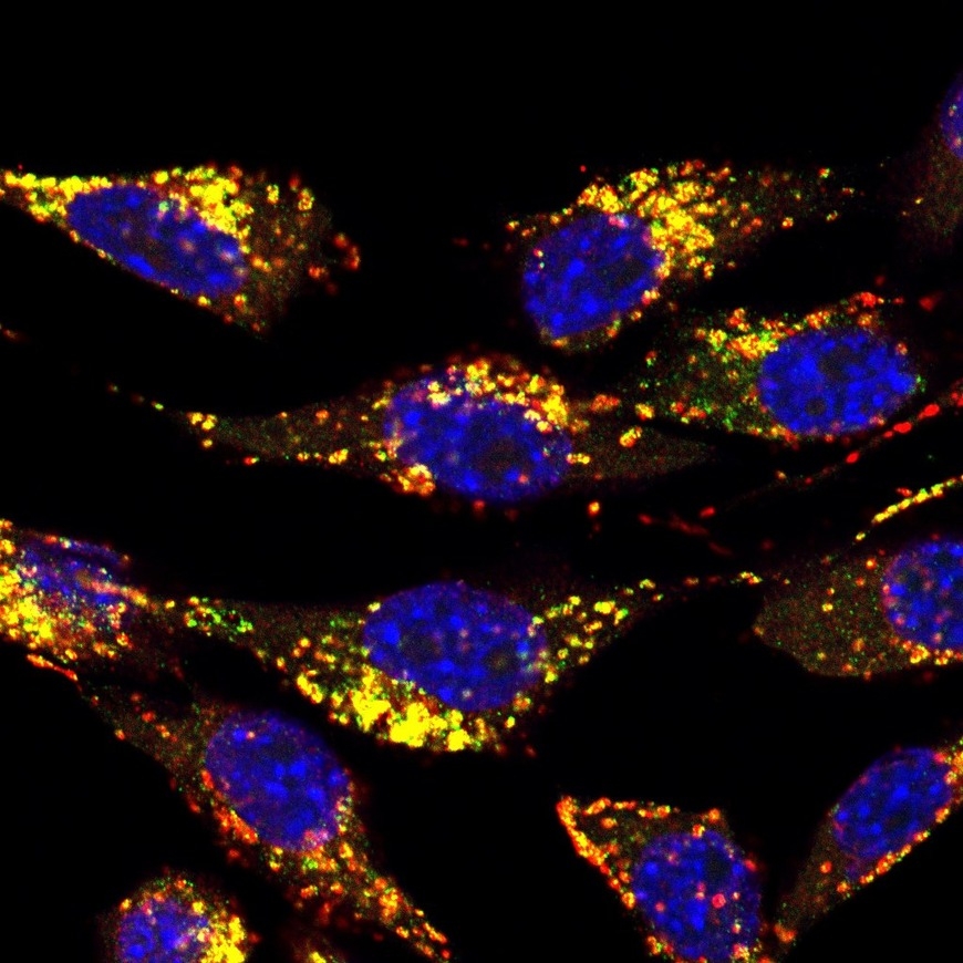 Cellular waste removal differs according to cell type