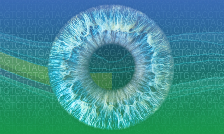 Large-scale study enables new insights into rare eye disorders