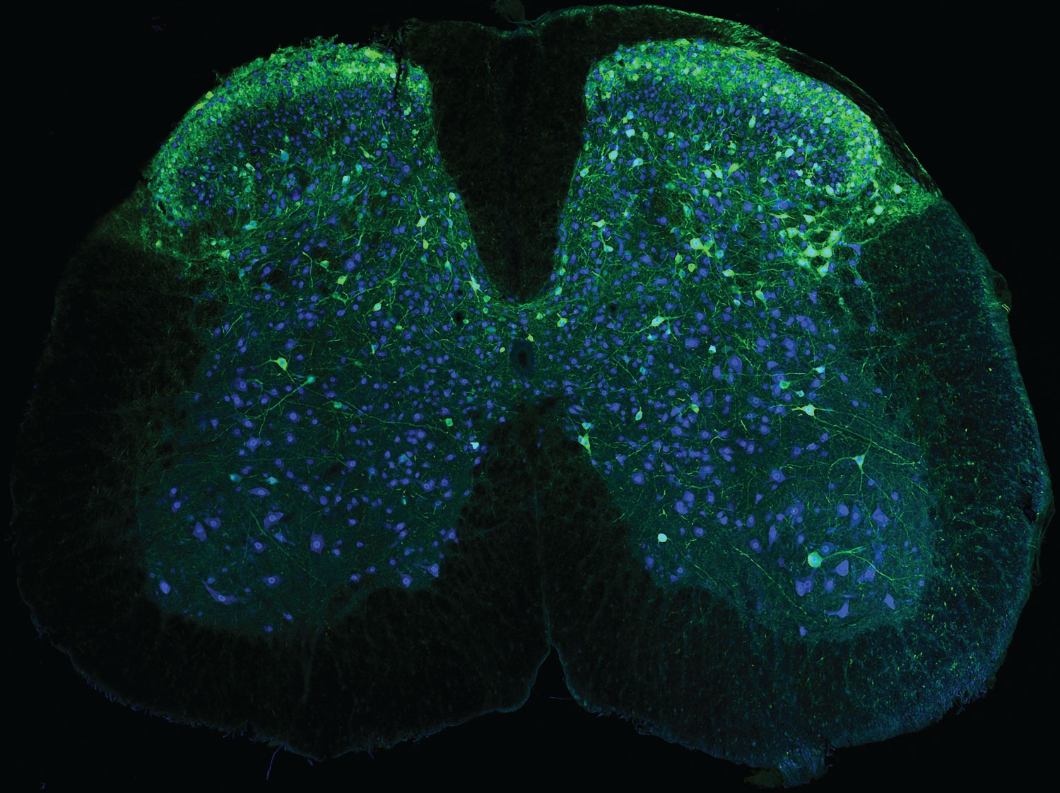 WEARABLE MICROSCOPES ADVANCE SPINAL CORD IMAGING IN MICE