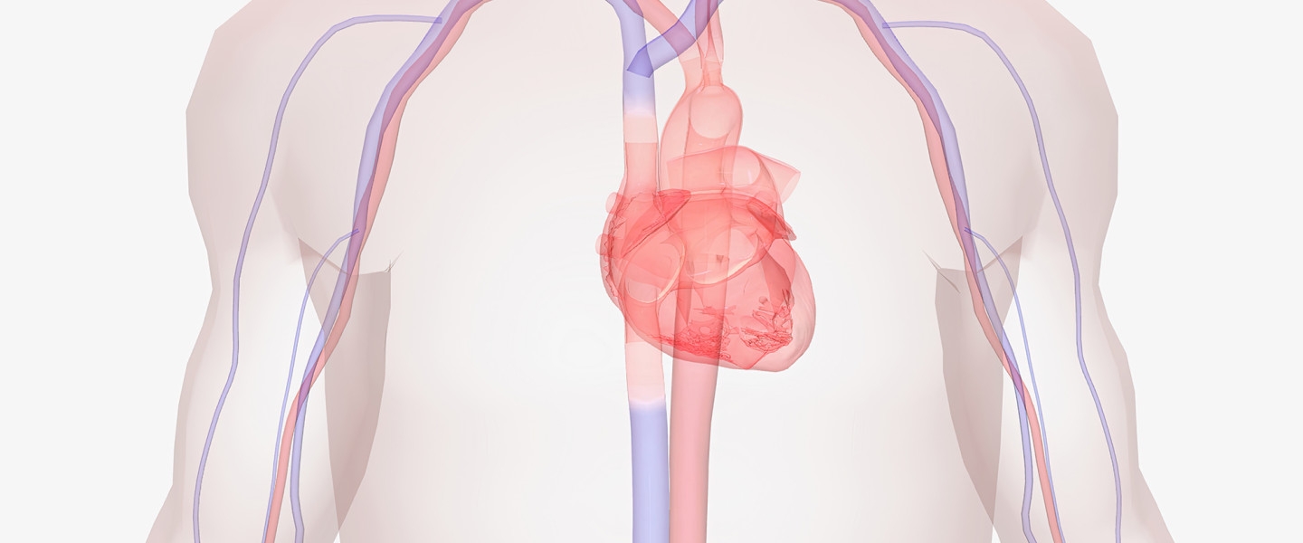 Arterial stiffness may cause metabolic syndrome in adolescents via an increase in fasting insulin and LDL-cholesterol