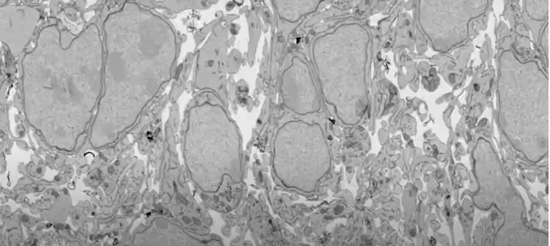 IDENTIFICATION OF TUNNELS CONNECTING NEURONS IN THE DEVELOPING BRAIN