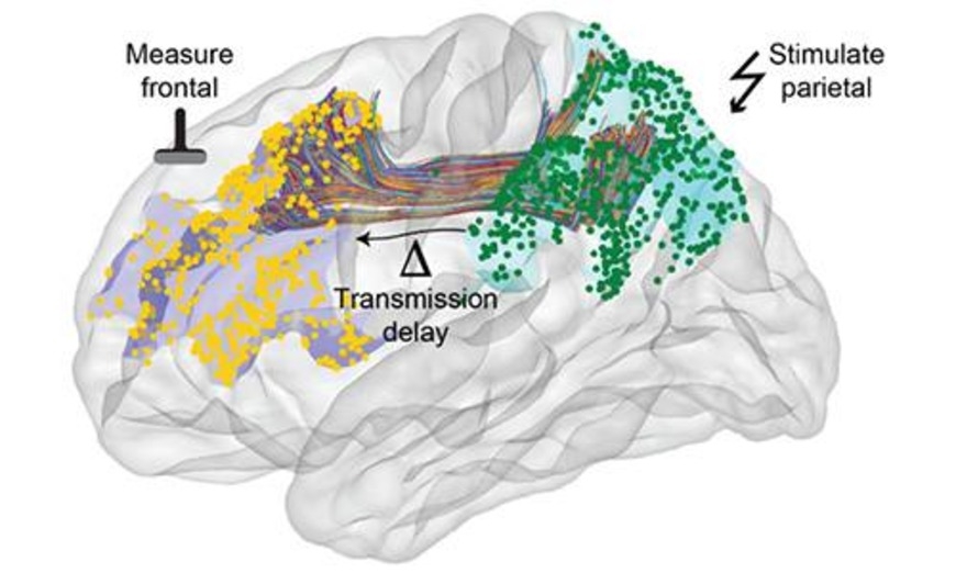 Understanding the Speed of Brain Communication