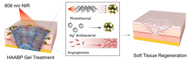 Hydrogel Injections Treat Antibiotic-Resistant Infections After Hip, Knee Replacements