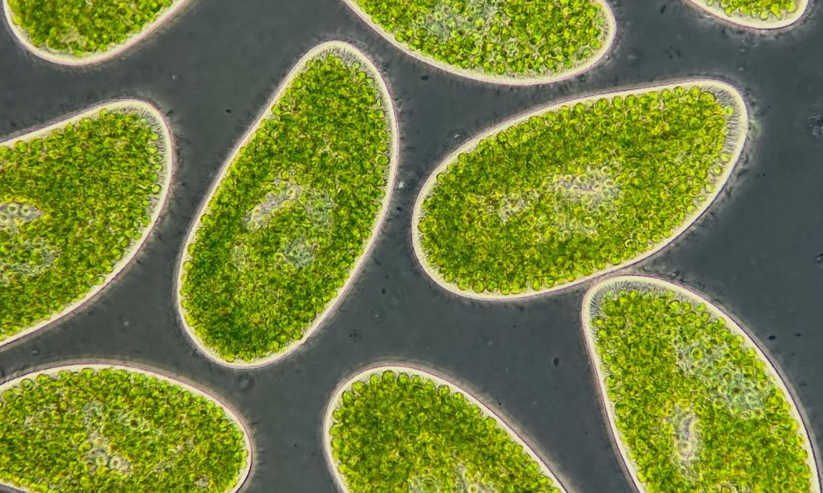 Little-Known Microbes Could Help Predict Climate Tipping Points