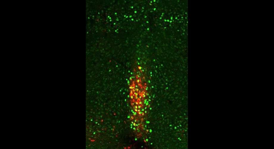 How cold temperatures trigger the brain to boost appetite