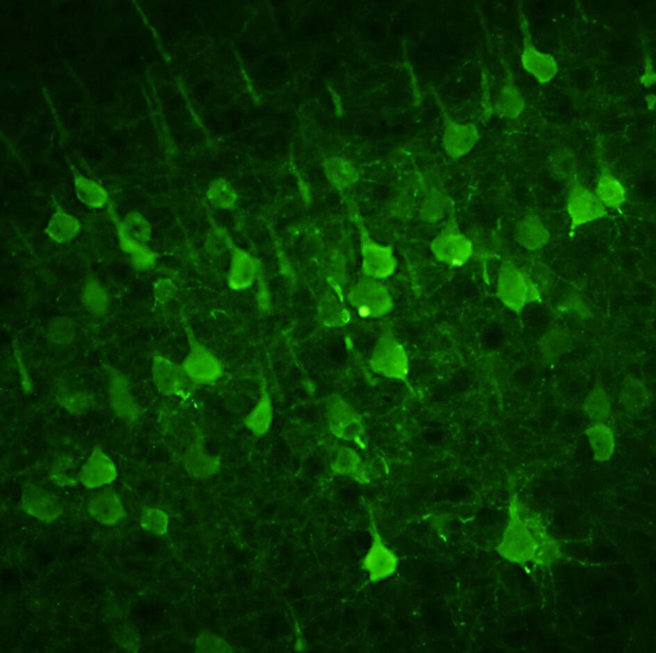 New Insights into the Protein-Mediated Motor Neuron Loss in Amyotrophic Lateral Sclerosis