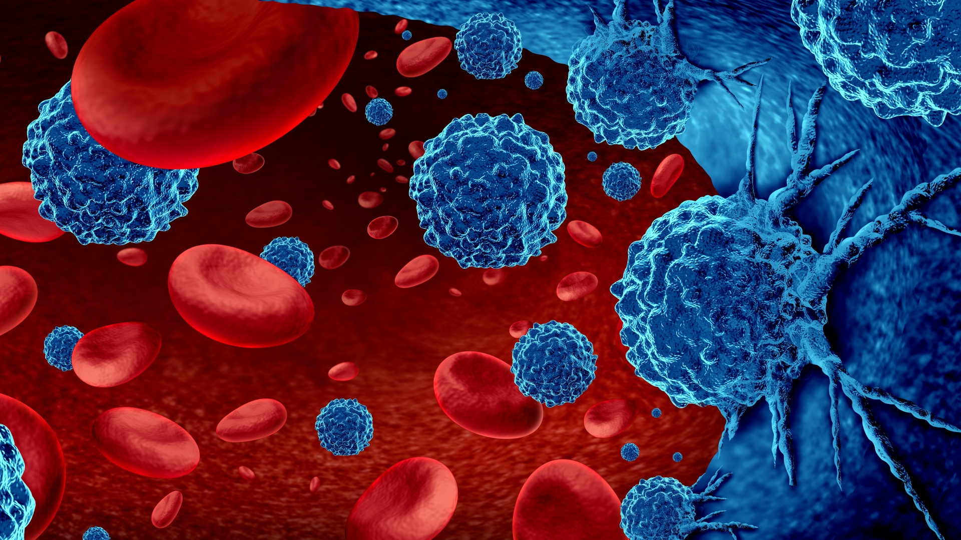 New insights to enhance treatment and diagnosis of blood cancer
