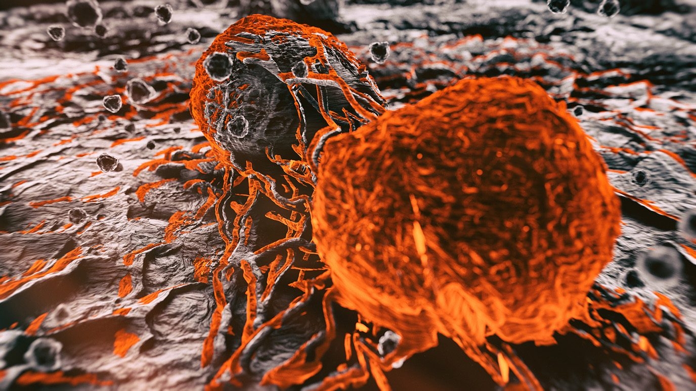 Lung cancer outcomes significantly improved with immunotherapy-based treatment given before and after surgery