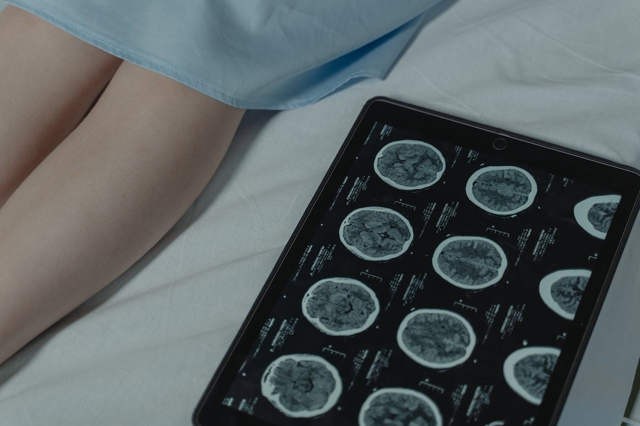 Brain Connectivity Is Disrupted in Schizophrenia