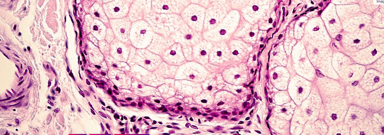 Psoriasis not caused by spontaneous mutations in skin cells