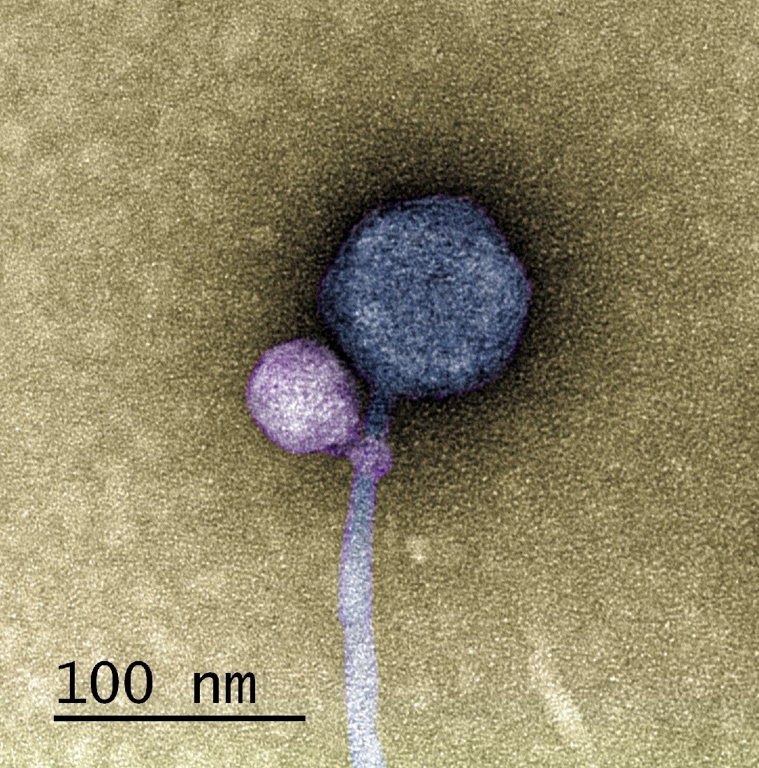 UMBC team makes first-ever observation of a virus attaching to another virus