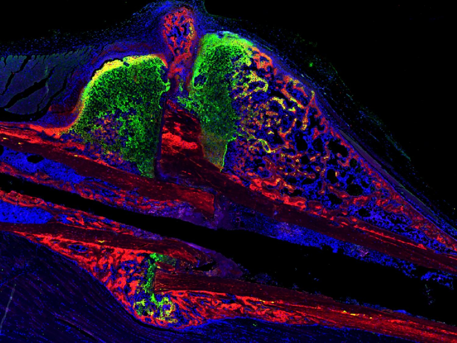 CBD and CBG may promote bone fracture healing, manage pain