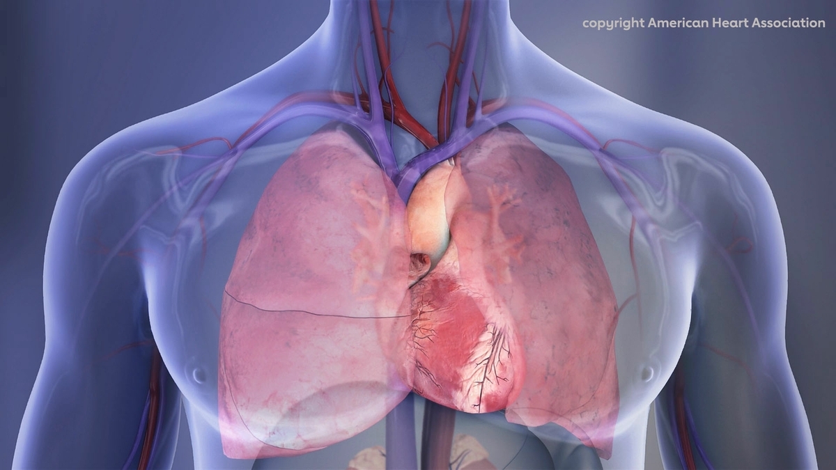 Reducing systolic blood pressure to less than 120 mm Hg reduced cardiovascular event risk