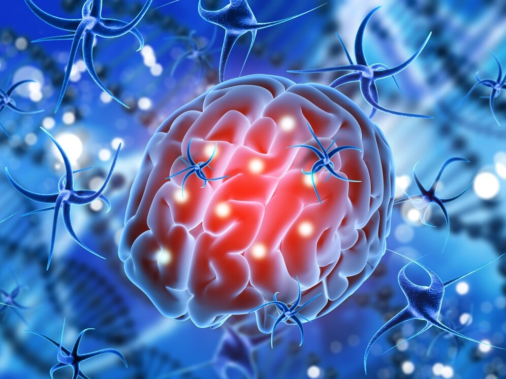 Salty immune cells surrounding the brain linked to hypertension-induced dementia