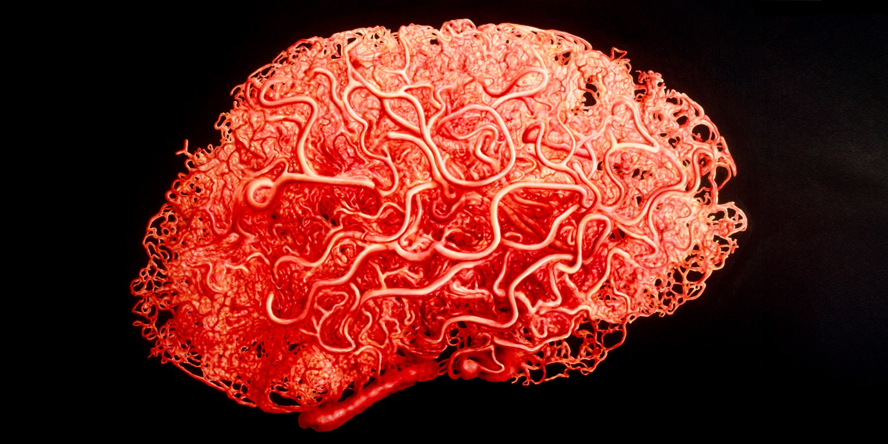Riding sound waves in the brain