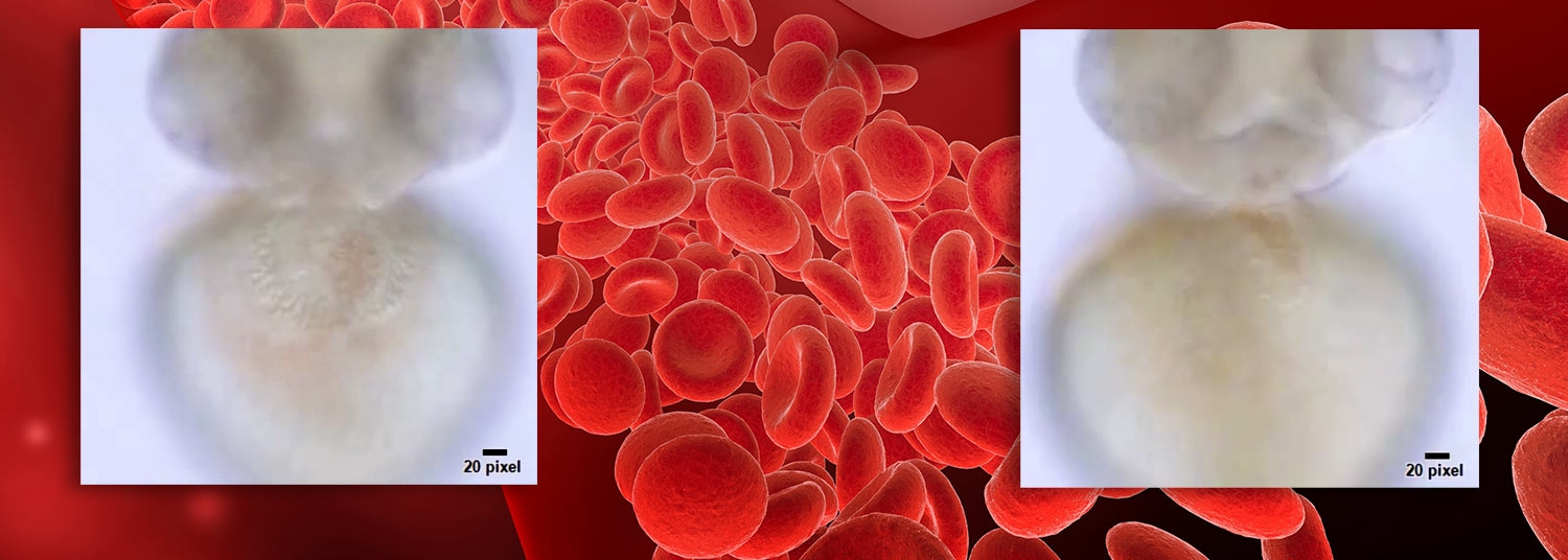 UMSOM Researchers Discover First Ever Link Between Hemoglobin-Like Protein and Normal Cardiac Development
