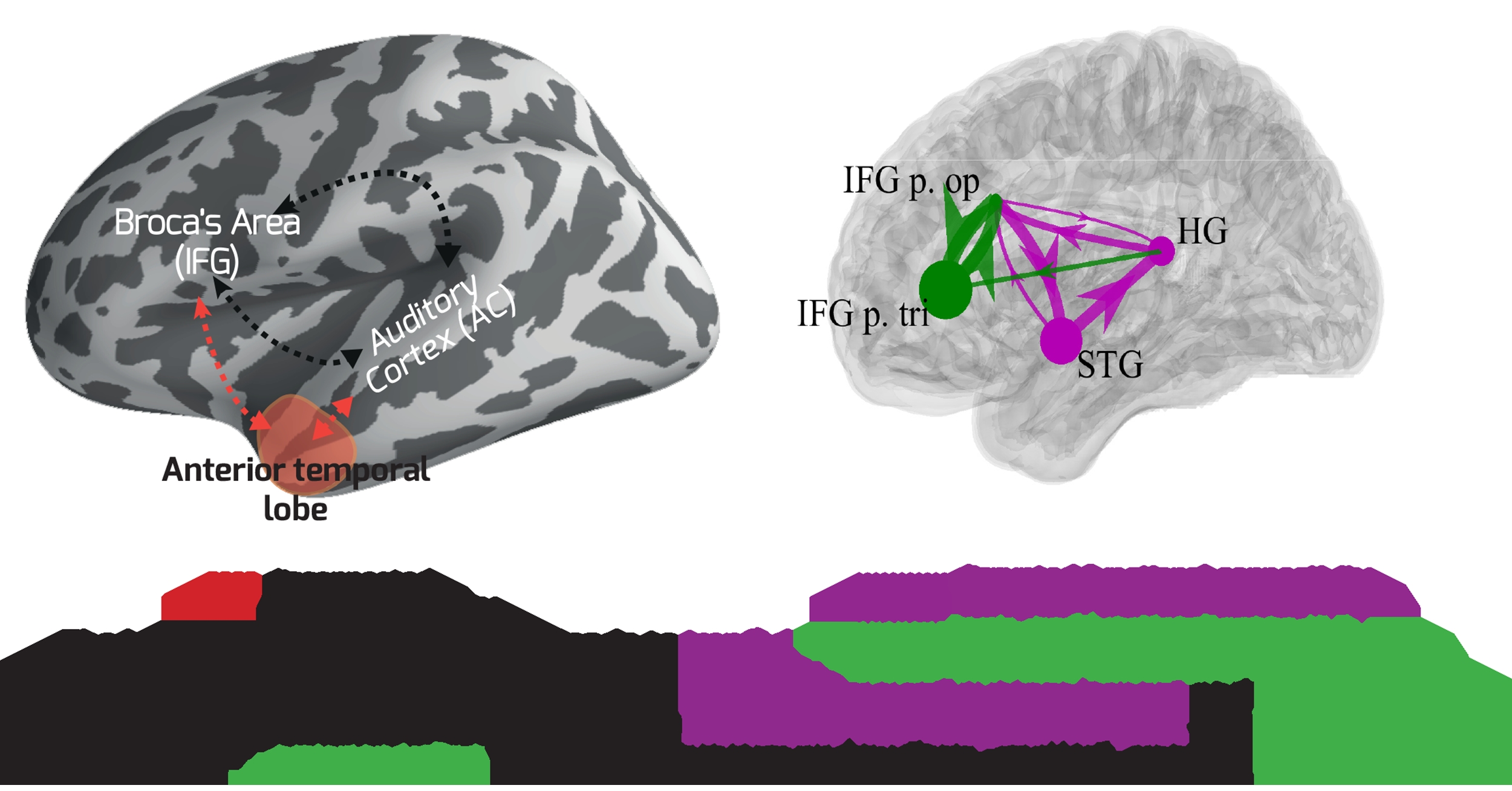 Rare experiment during brain surgery helps researchers better understand neural networks