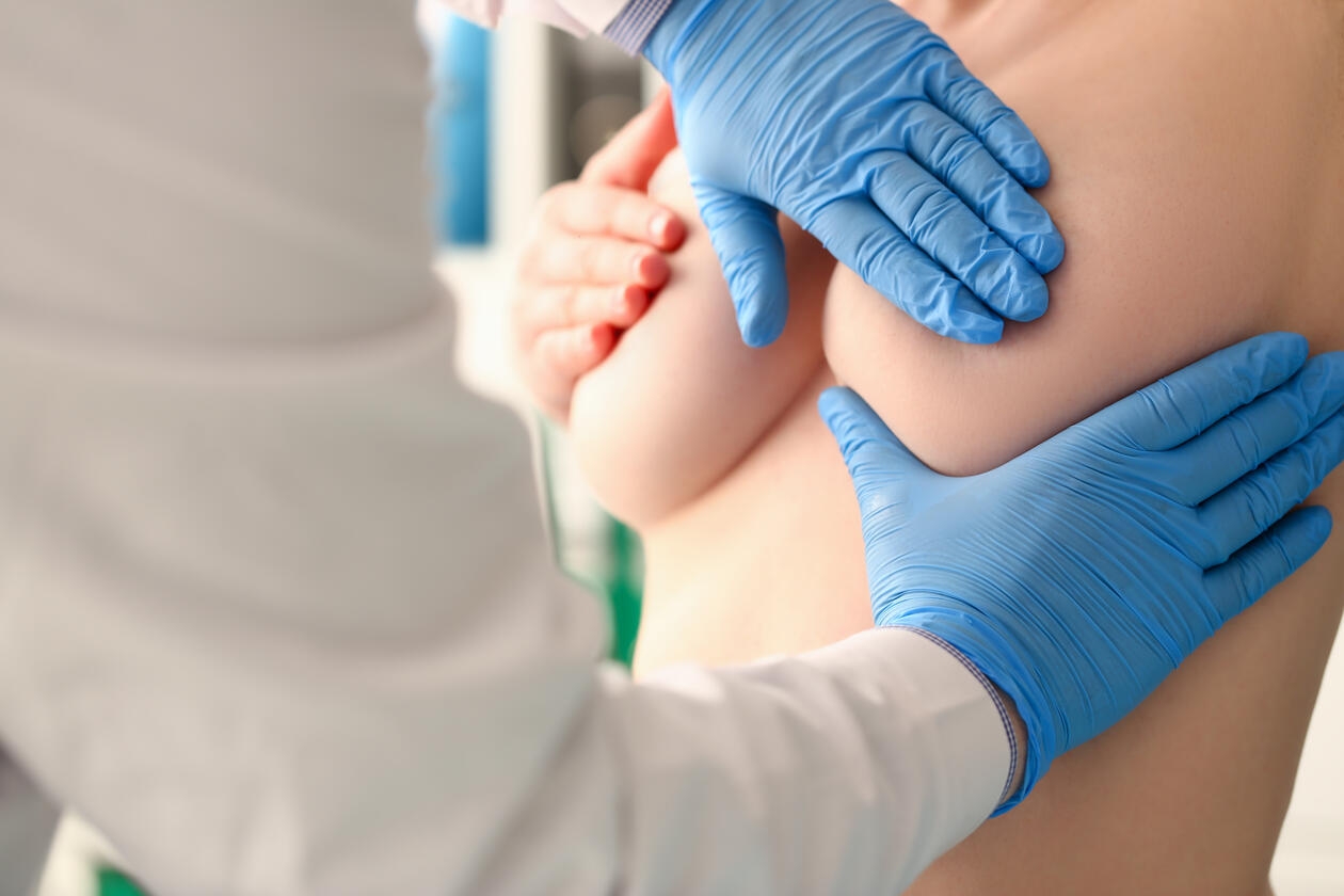 Early life gene epimutation may cause breast cancer