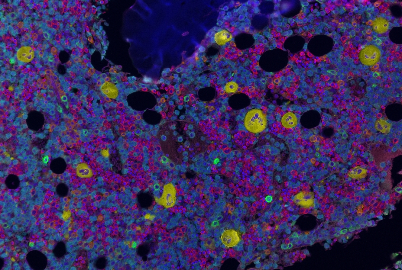 Researchers Chart the Contents of Human Bone Marrow