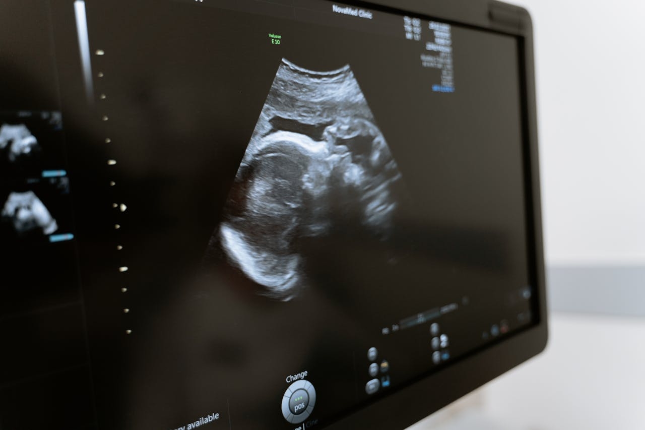 AI CAN NOW DETECT COVID-19 IN LUNG ULTRASOUND IMAGES