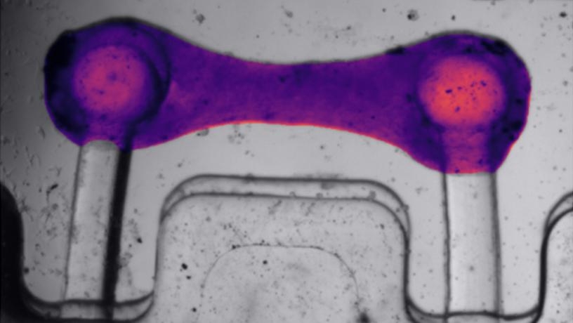 A Pulse of Innovation: AI at the Service of Heart Research