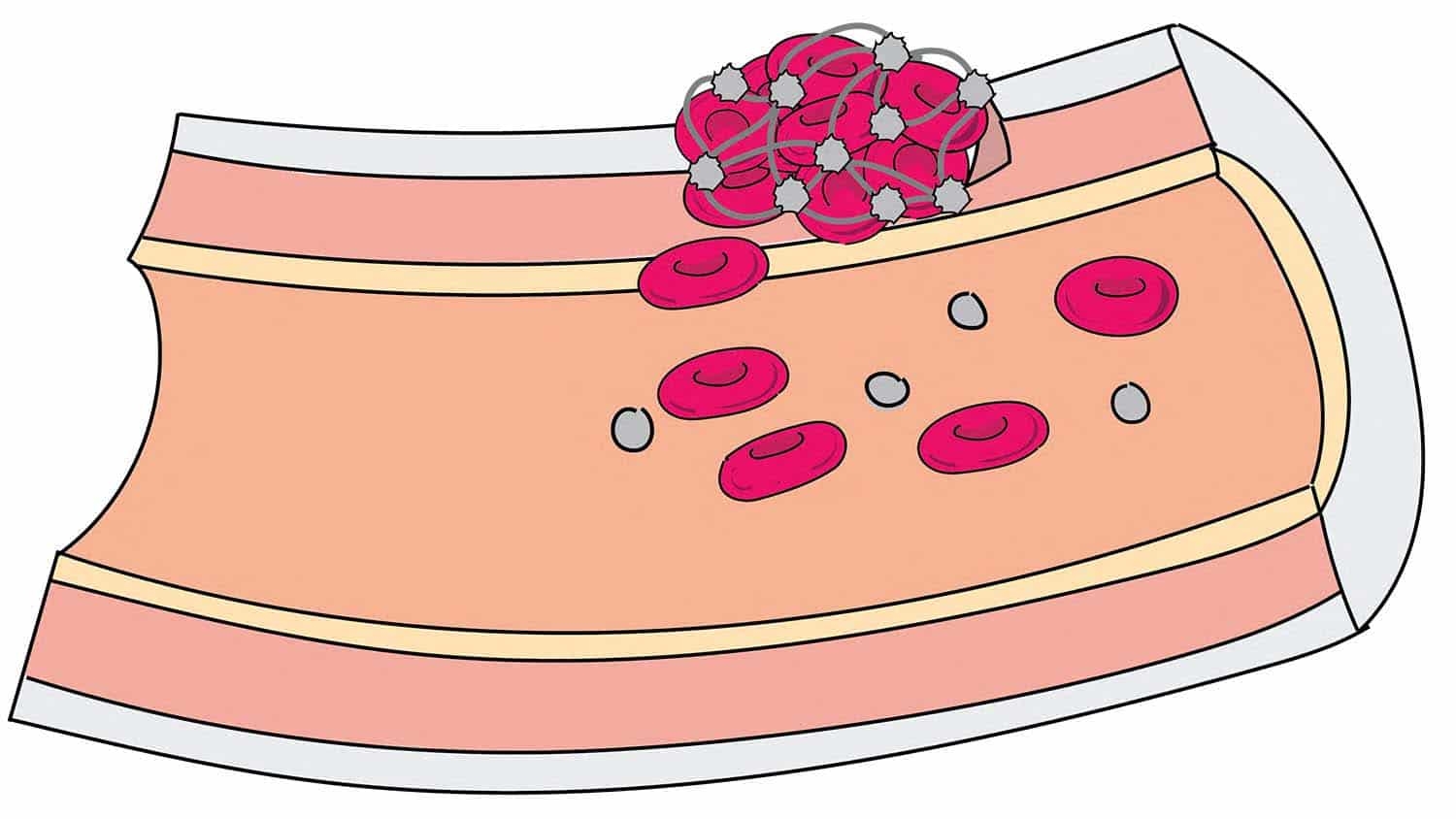 Synthetic Platelets Stanch Bleeding, Promote Healing in Animal Models