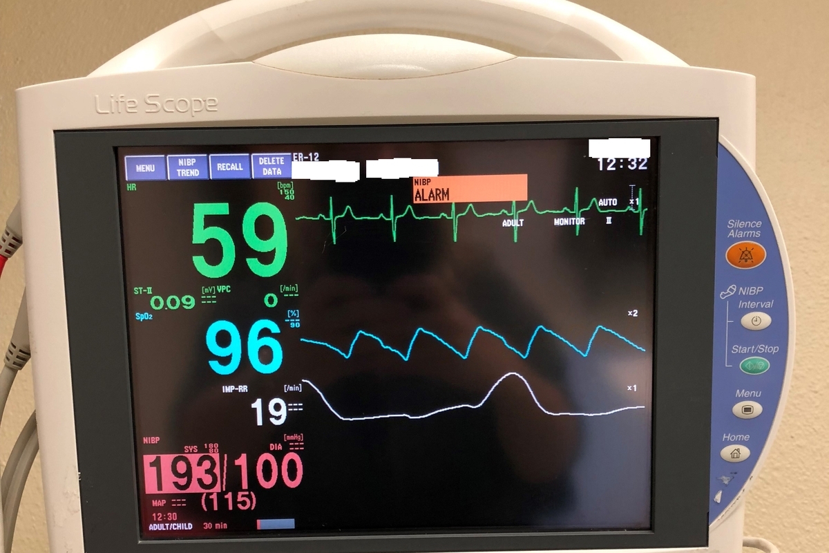Adults with congenital heart disease faced higher risk of abnormal heart rhythms