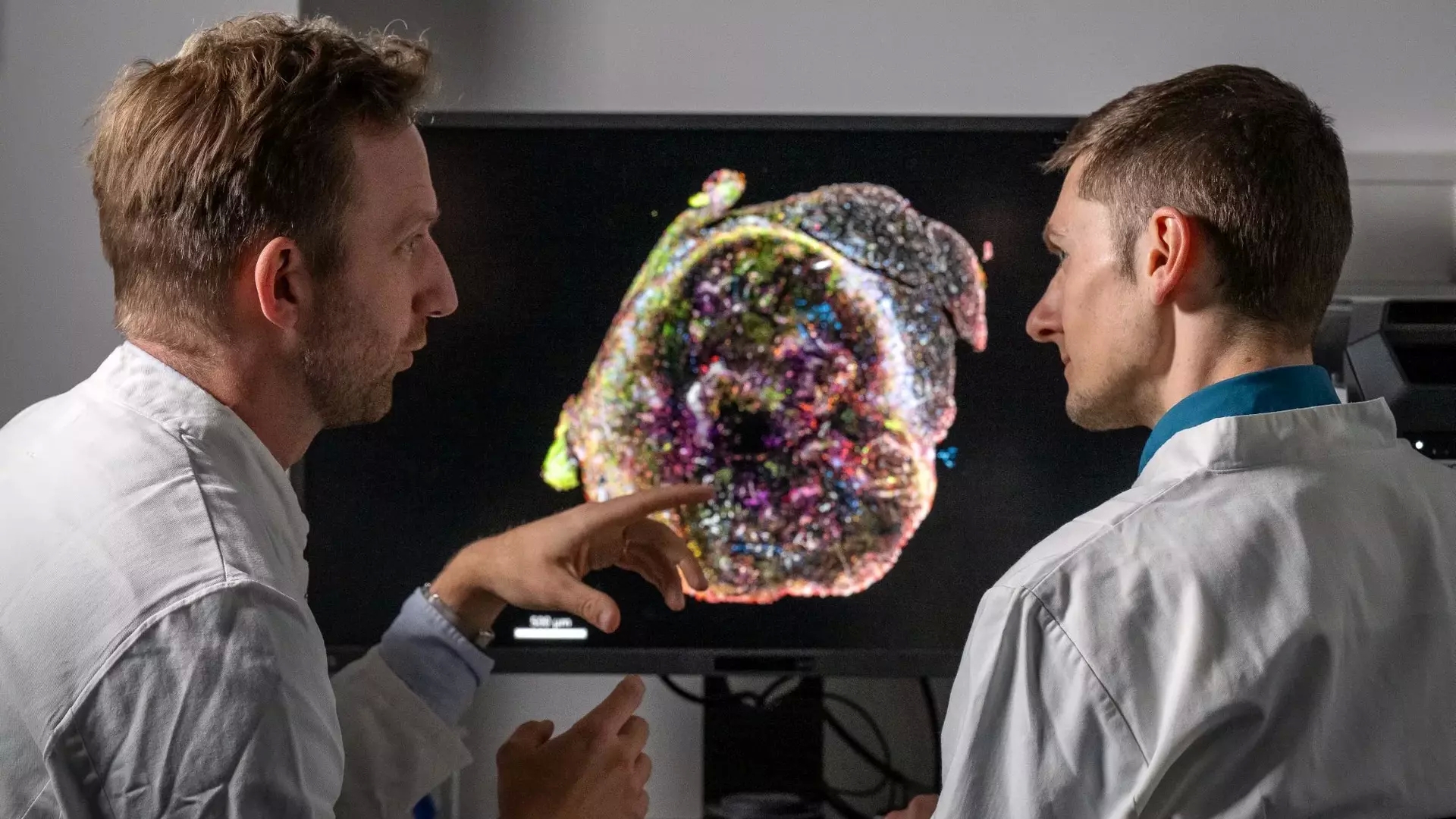 Tumor cells evade the immune system early on