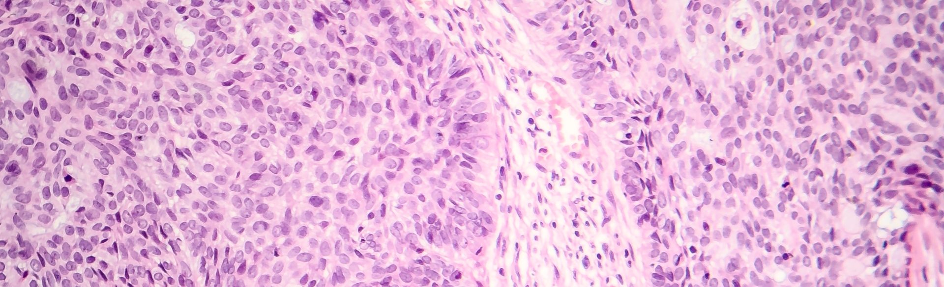 Novel Software Combines Gene Activity and Tissue Location to Decode Disease Mechanisms