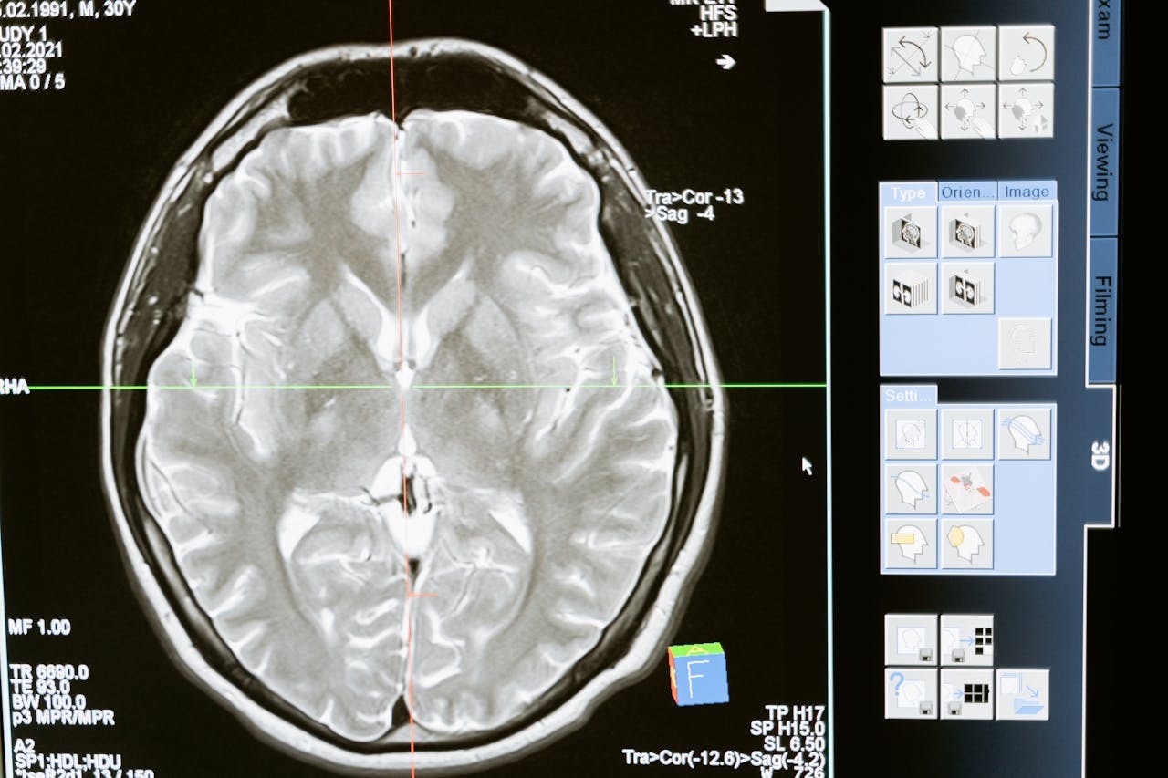 Light Therapy Increases Brain Connectivity Following Injury