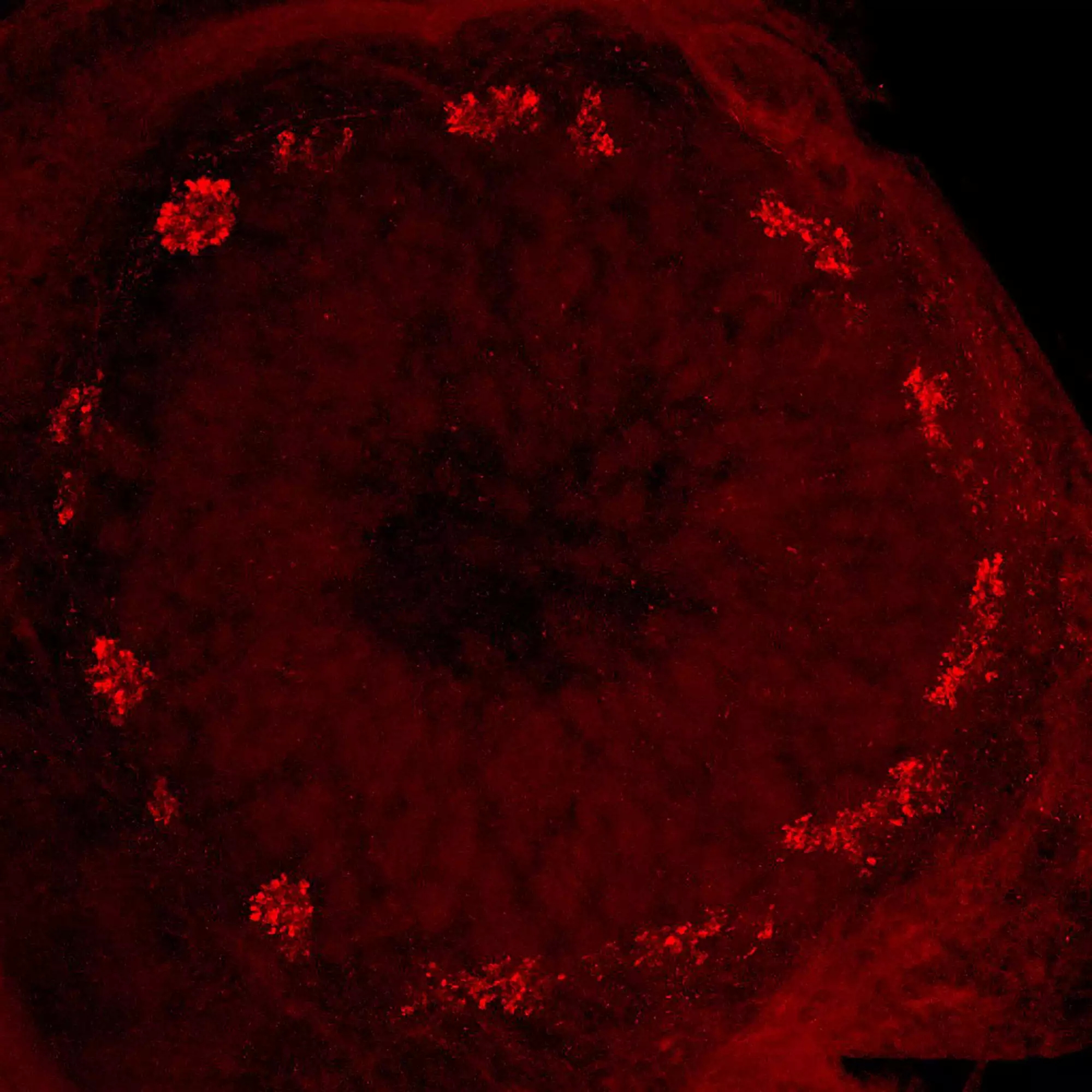 Odors are encoded in rings in the brain of migratory locusts