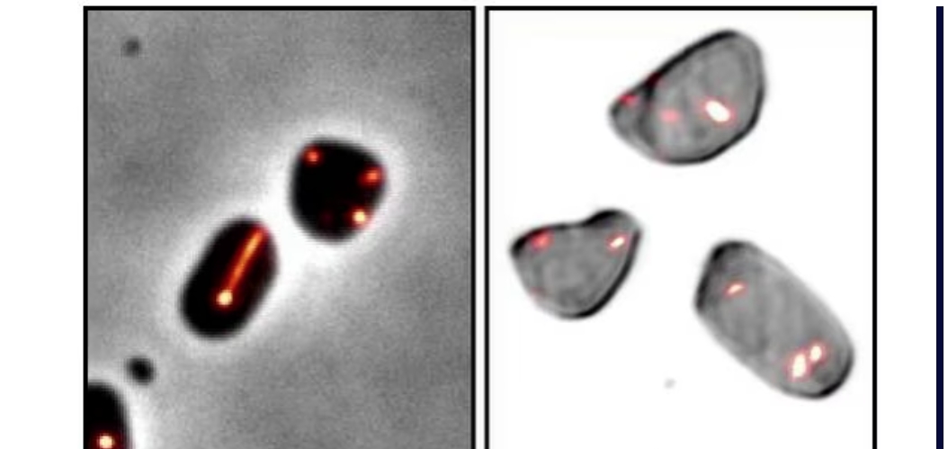 Deconstructing the structural elements of a lesser-known microbe