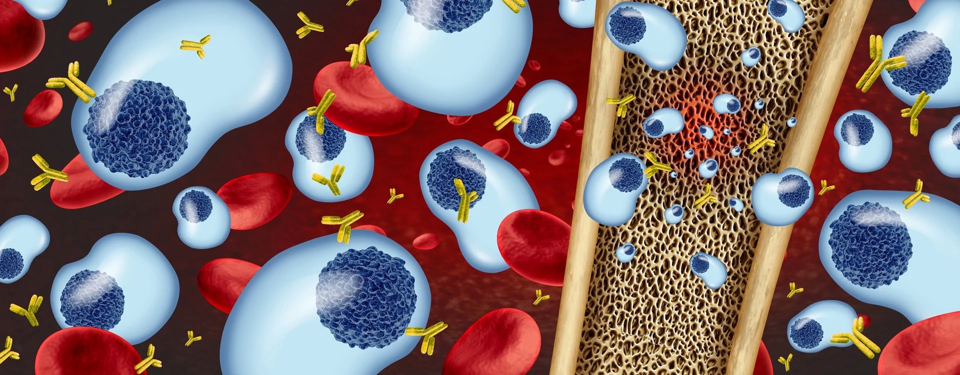 Moffitt Develops First Individualized Predictive Model for Multiple Myeloma Treatment