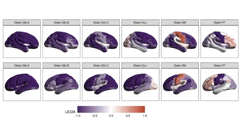 Patterns of brain connectivity differ between preterm and term babies