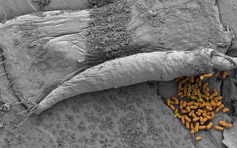Artificial bladders shine light on bugs that cause urinary tract infections