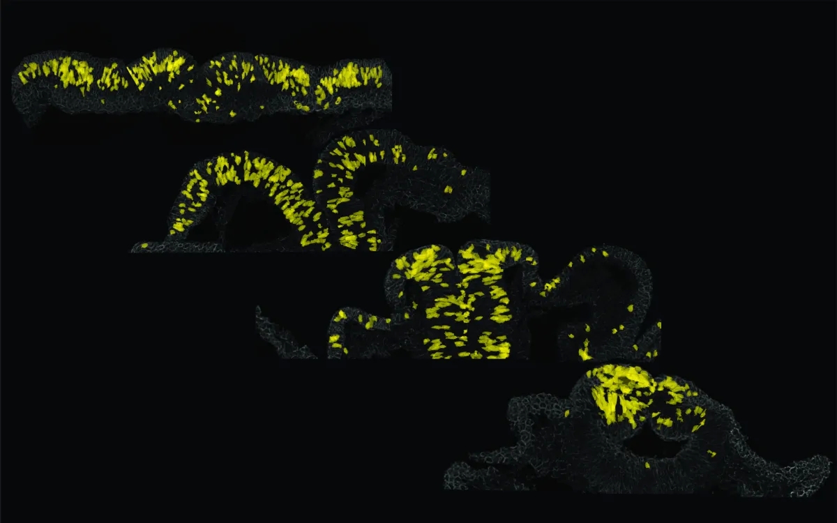 New information on the most important early stage of embryonic development