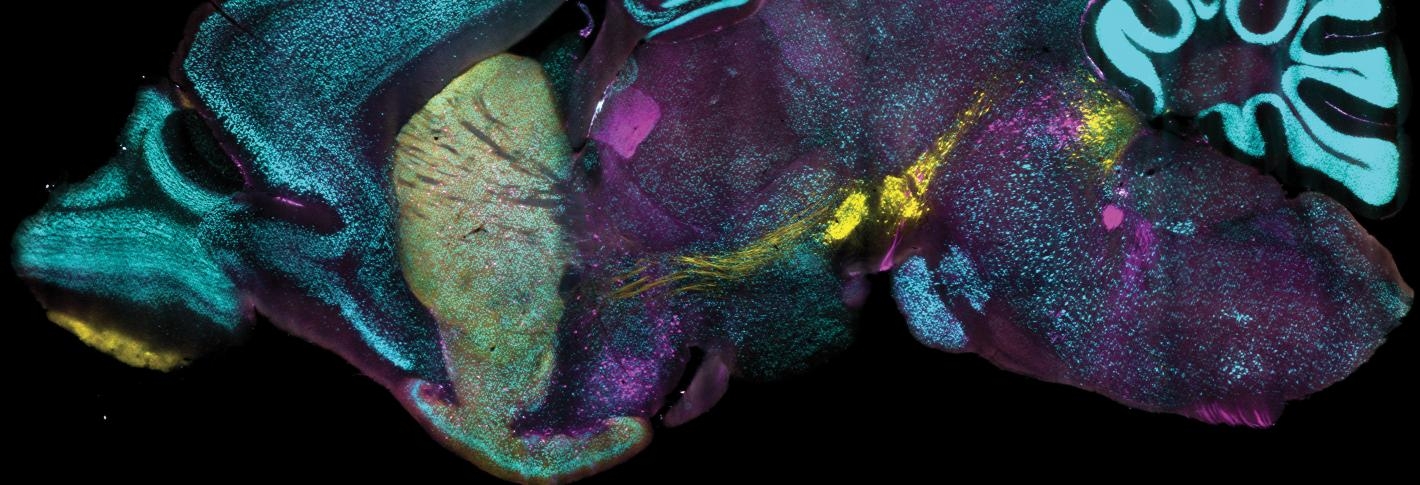 MIT method enables ultrafast protein labeling of tens of millions of densely packed cells in organ-scale tissues