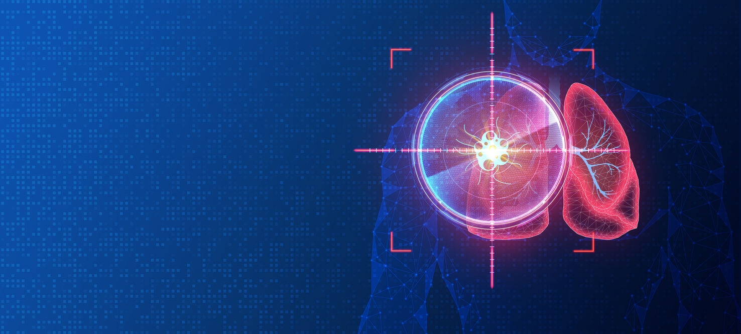 Moffitt Study Shows AI Boosts Efficacy of Cancer Treatment, But Doctors Remain Key