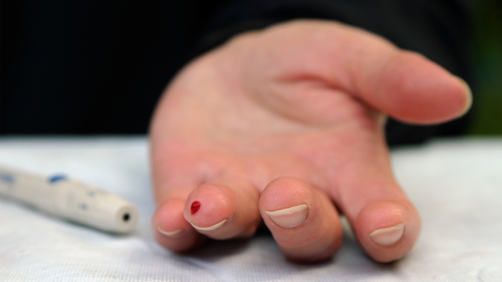 Simple blood test for IBS-triggering foods shows promise in study