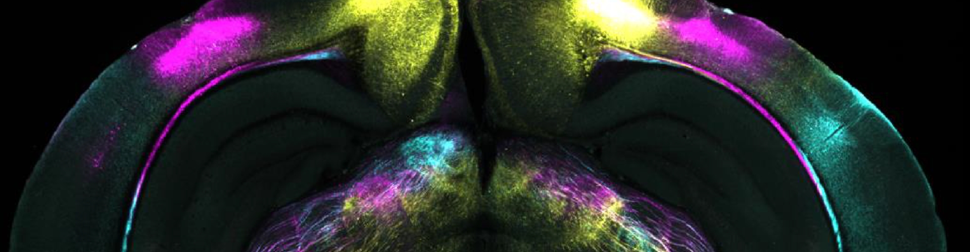 Scientists discover brain mechanism that helps overcome fear