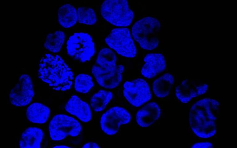 New tool reveals disruption of immune cells in blood is linked to cancer outcomes