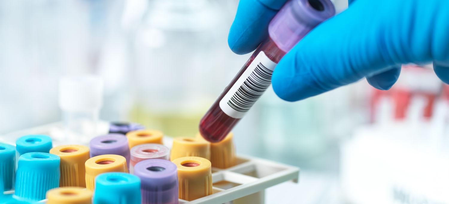 Gene-Based Blood Test for Melanoma May Catch Early Signs of Cancer’s Return
