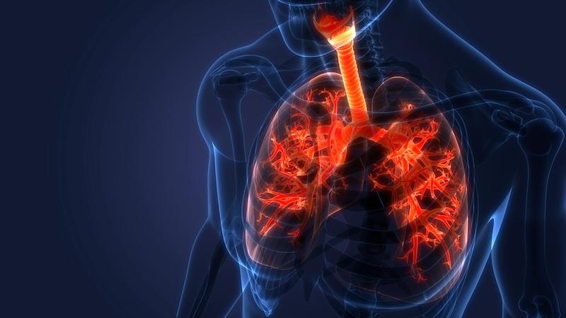 Pulmonary fibrosis has no cure. Could a cancer drug hold the answer?